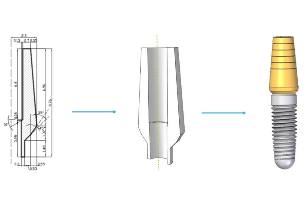 FEM dental implant