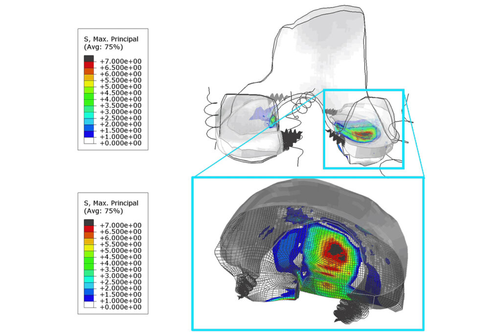 knee simulation