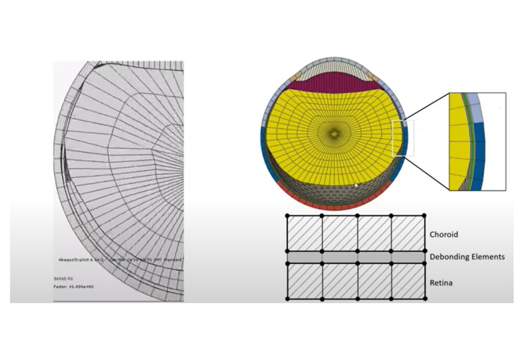 retinal simulation